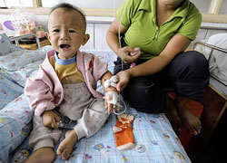 Một em bé Trung Quốc bị sạn thận do uống sữa bẩn hồi năm 2008