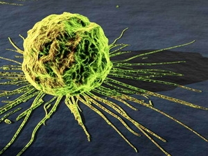 Tế bào ung thư. (Nguồn: Internet)