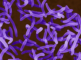 Vi trùng tả Vibrio cholerae