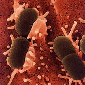 Vi khuẩn E.coli trong máu gây nhiễm khuẩn huyết.