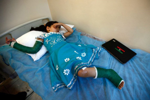 Ngày 3/6, Malak Al Shami, 6 tuổi, đã phải phẫu thuật cắt chân sau khi nhà em bị dính rocket của lực lượng trung thành với đại tá Muammar Gaddafi. Em gái Rodaina, 1 tuổi và em trai Mohamed, 3 tuổi, đã chết trong vụ tấn công. Ảnh Reuters. 
